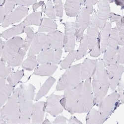 TMEM106B Antibody, Novus Biologicals 0.1mL; Unlabeled:Antibodies, Polyclonal